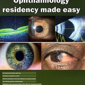 Ophthalmology residency made easy (Color)