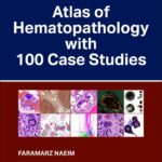 Atlas of Hematopathology with 100 Case Studies (Color