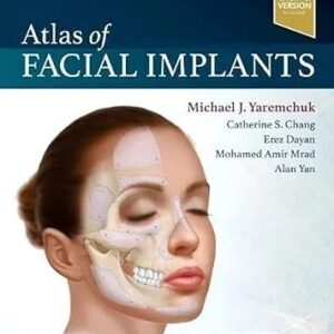 Atlas of Facial Implants (Color)